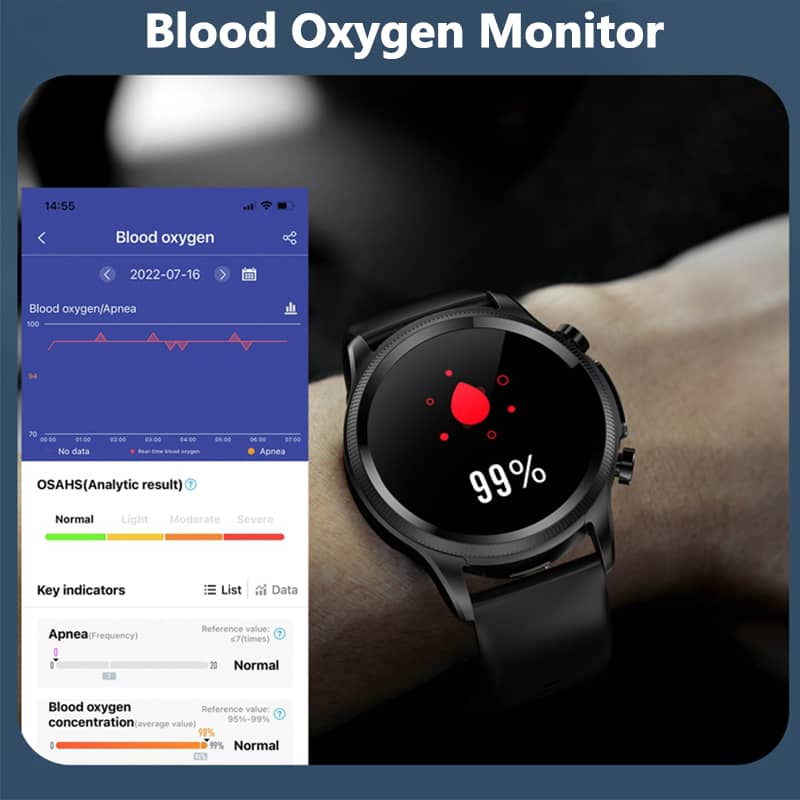 Findtime presión arterial reloj inteligente Monitor ECG SpO2